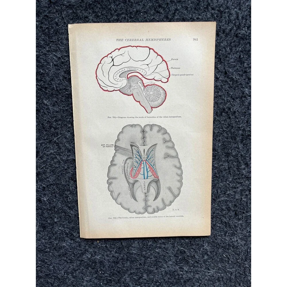 Original 1913 Anatomy Pages of Human Body, Anatomy Physiology Textbook Gifts, T